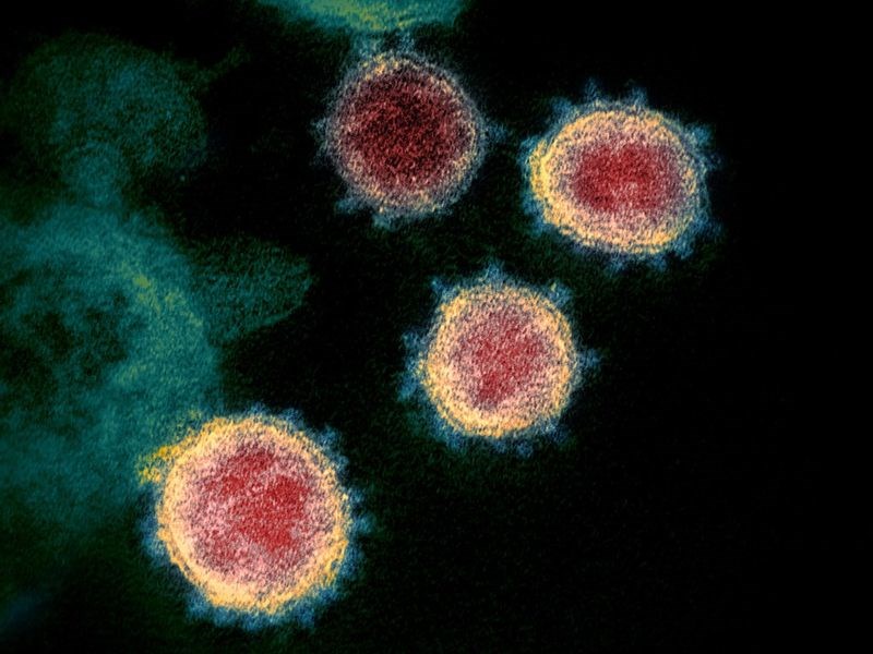 Image of the 2019 novel coronavirus from NIAID flickr (credit: NIAID-RML )