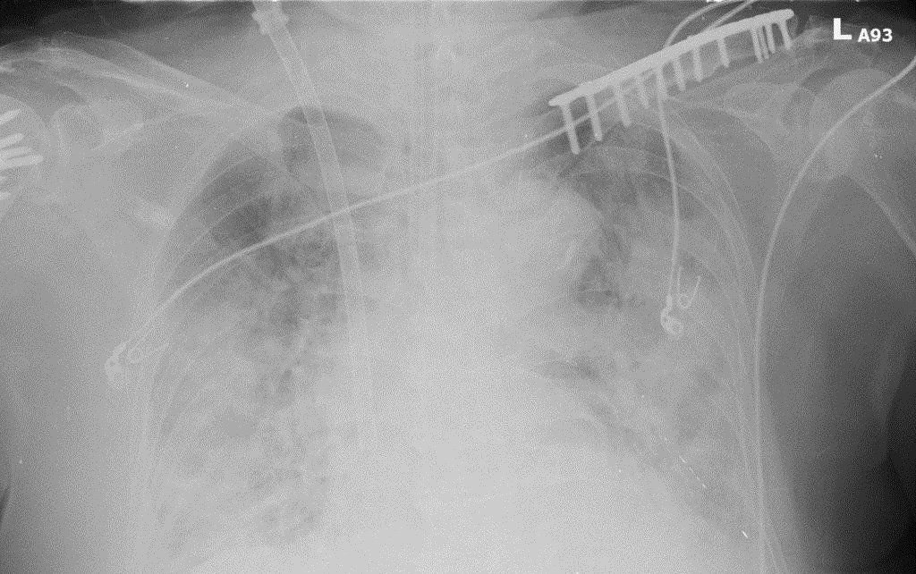 An X-ray image of the patient