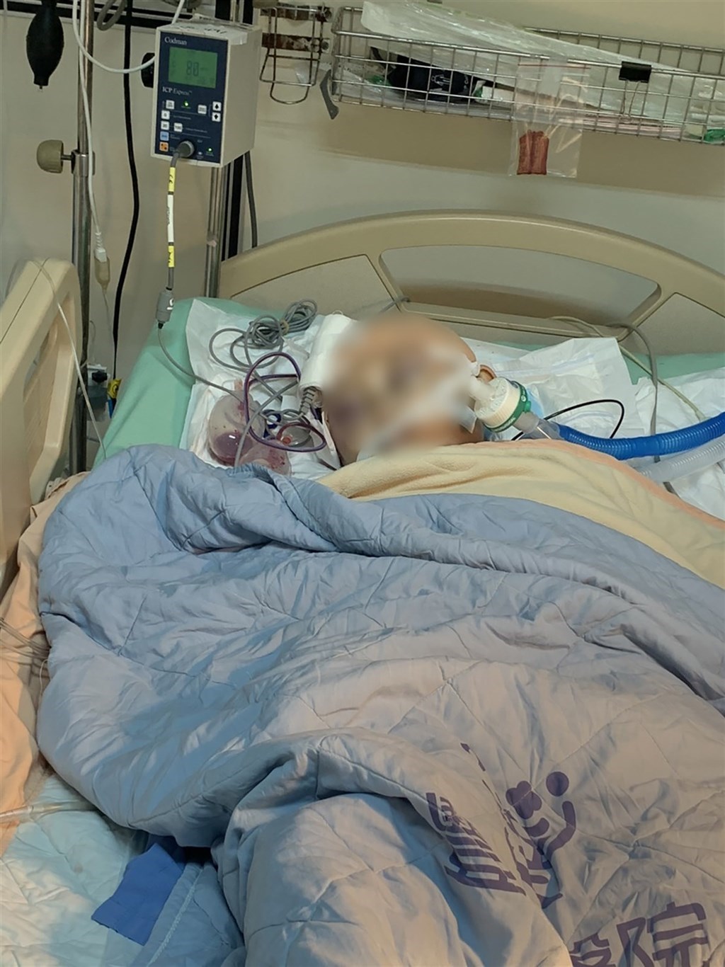 7-year-old injured in judo class dies after 70-day coma - Vimarsana News