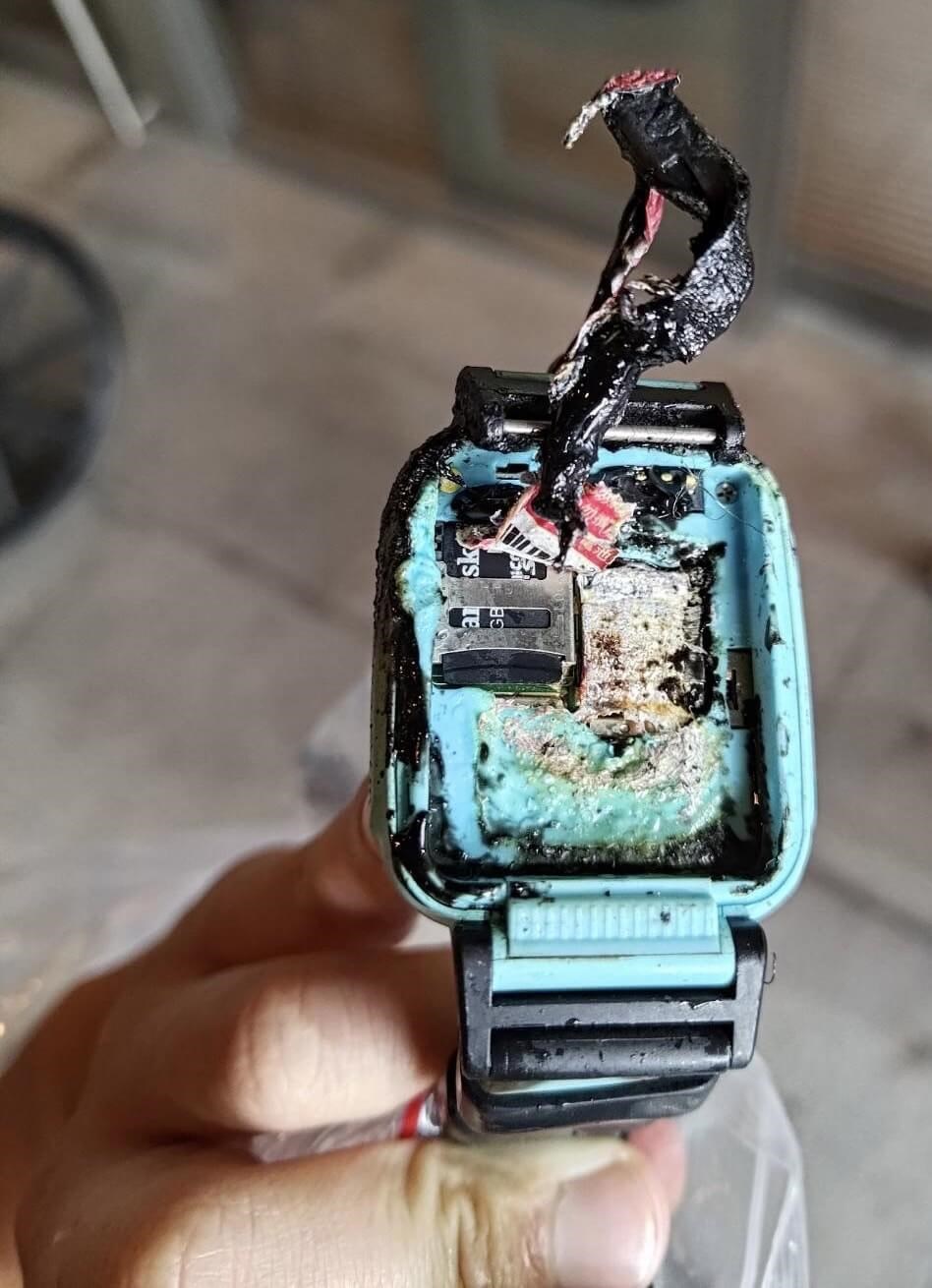 Smartwatch brand offering free checks after combustion of student's device - Vimarsana News