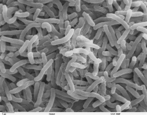Taiwan reports 1st domestic case of cholera since 2023: CDC