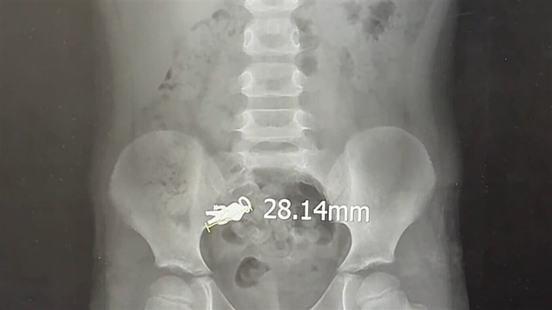 Photo courtesy of the Lotung Poh-Ai Hospital Sept. 9, 2025