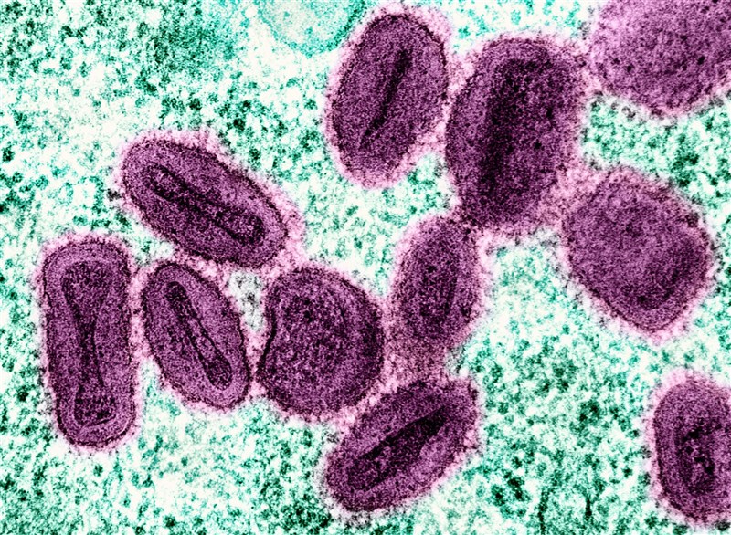 A microscopic image of Mpox virus for illustrative purposes only. Image by NIAID, CC BY 2.0, via Wikimedia Commons
