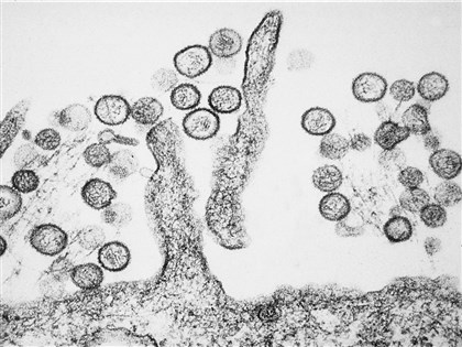 Taiwan records 2nd hantavirus case this year: CDC
