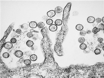 No community risk from cruise passenger linked to hantavirus outbreak: CDC
