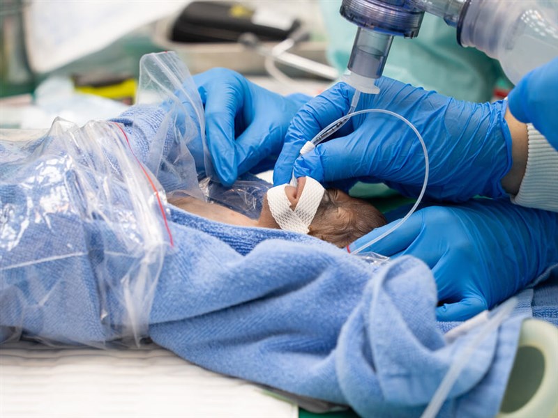 Taipei Zoo welcomes rare orangutan twins delivered by cesarean section