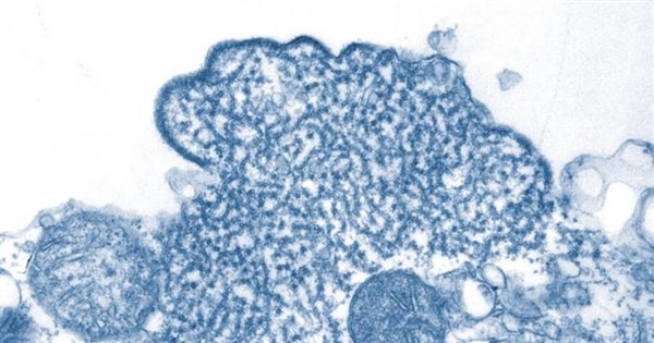 Taiwan lists Nipah virus as Category 5 disease