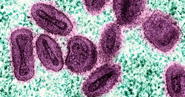 Taiwan records first domestic cases of Mpox clade Ib strain - Focus Taiwan