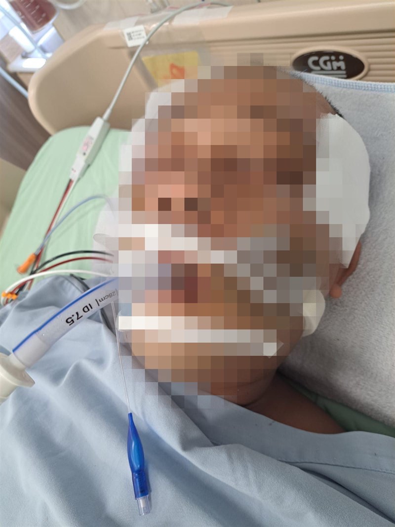 Lutfi, PMI yang berasal dari Kediri, Jawa Timur ini mengalami patah rahang belakang, patah kaki sebelah kiri, rusuk bagian bawah patah dan cedera otak kritis. (Sumber Foto : Istri Lutfi).