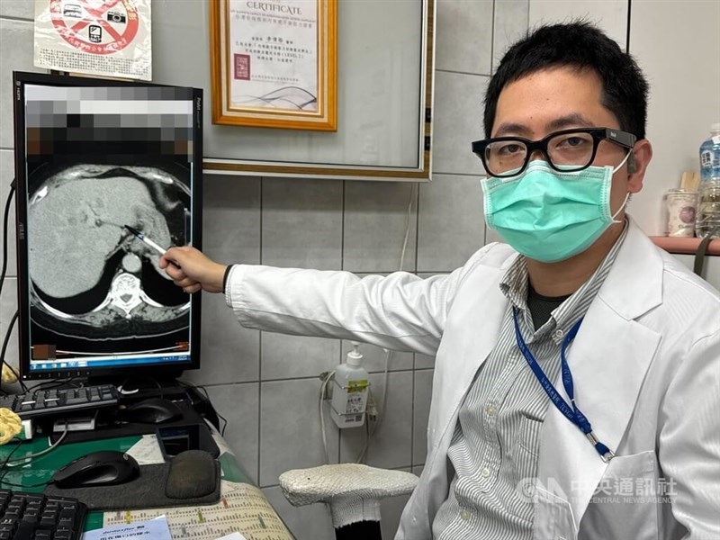 Dokter bedah Wu Kun-ta di Lee General Hospital mengimbau masyarakat memperhatikan gizi seimbang, mengontrol pola makan, dan mengembangkan kebiasaan olah raga untuk mengurangi pembentukan perlemakan hati. (Sumber Foto : Dokumentasi CNA)