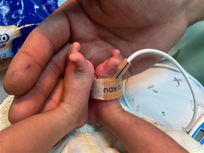 Perjalanan ambulans bayi prematur dapat dukungan dari seluruh Taiwan