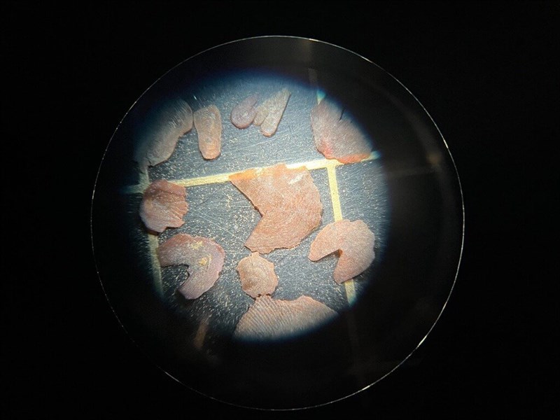 台南市の遺跡で出土した魚のうろこ(同市政府提供)