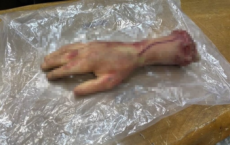 トラックの屋根から路上に落下したヒトの手首の形をしたジョークグッズ＝市民提供（画像の一部を加工しています）