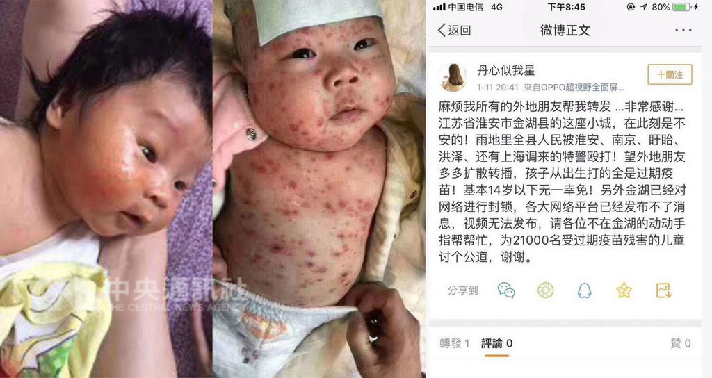 江蘇省淮安市金湖縣近一個月有145名嬰幼兒在一家衛生院接種過期小兒麻痺疫苗。許多受害家長在網上控訴孩子出現高燒、紅疹等不良反應。(翻攝自微博)中央社 108年1月12日
