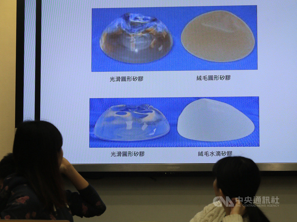 法國日前拒絕某廠牌「絨毛型矽膠乳房植入物」的安全許可展延,遭質疑與間變性大細胞淋巴癌(ALCL)有關聯。民進黨立委林淑芬與台灣女人連線23日舉行記者會,呼籲衛福部等相關主管機關應積極測試,勿讓女性陷於健康風險中。中央社記者徐肇昌攝 108年2月23日