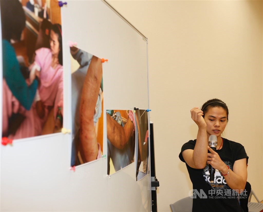 圖為許淑淨2018年6月4日現身展示手肘傷勢及治療過程照片,說明引退原因。(中央社檔案照片)