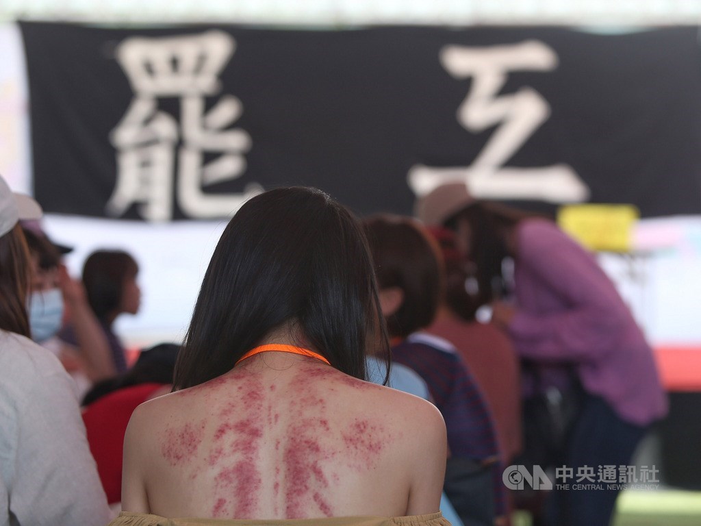 歷經17天罷工風波後,桃園市空服員職業工會6日與長榮航空簽下團體協約。圖為一名參與罷工的長榮空服員日前被拍到背上滿是刮痧痕跡。(中央社檔案照片)