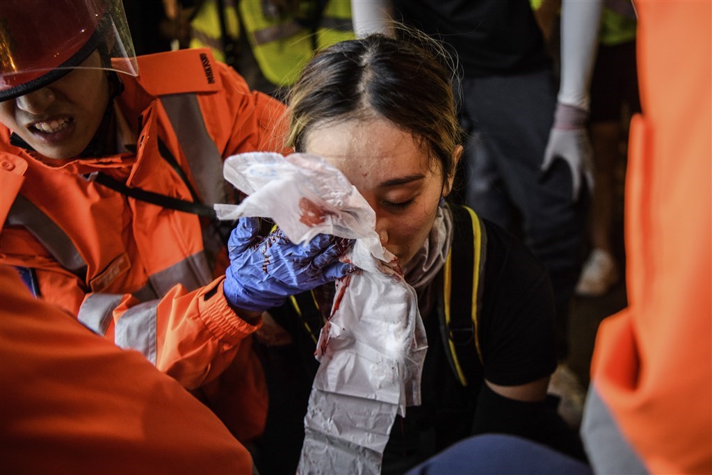 香港「反送中」抗爭11日遭警方空前強勢鎮壓,一名示威女子遭射爆右眼,引發黑衫軍強烈憤慨。(法新社提供)