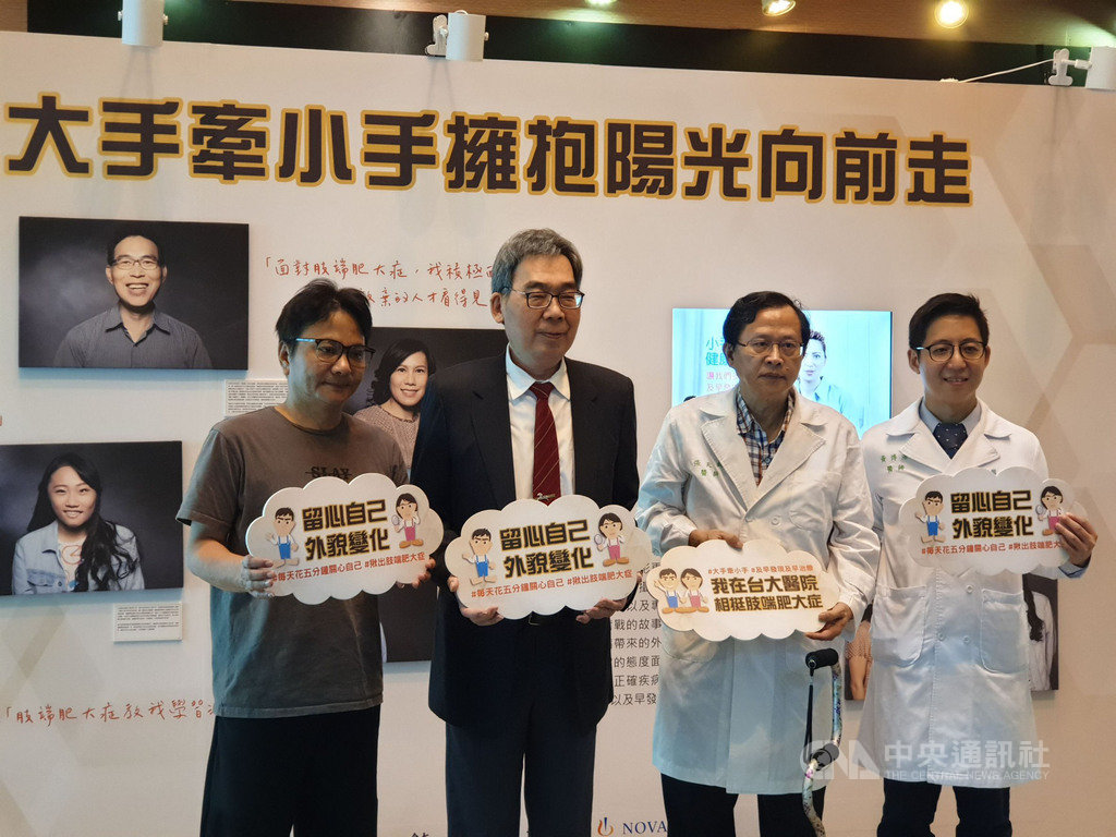 為了讓民眾更認識肢端肥大症,台大醫院舉辦「大手牽小手擁抱陽光向前走」策展活動,與知名攝影師合作,公益拍攝病友藝術照並在台大醫院展出。醫師提醒,肢端肥大症只要早期發現並及早治療,可維持良好生活品質。中央社記者陳偉婷攝 108年9月18日