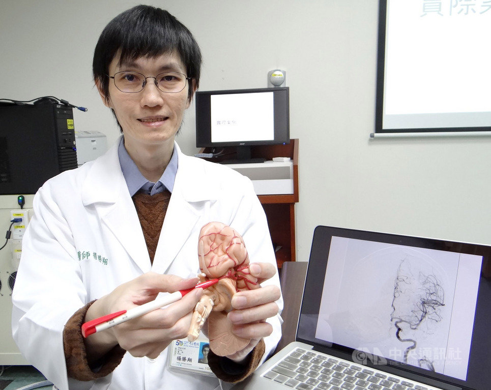 一名72歲何姓老翁今年4月因左側大腦動脈急性血栓阻塞倒臥路中,所幸經醫療團隊緊急施以經動脈取栓後,救回一命,奇美醫學中心神經內科醫師楊勝翔24日說明病例。(奇美醫學中心提供)中央社記者張榮祥台南傳真 108年9月24日