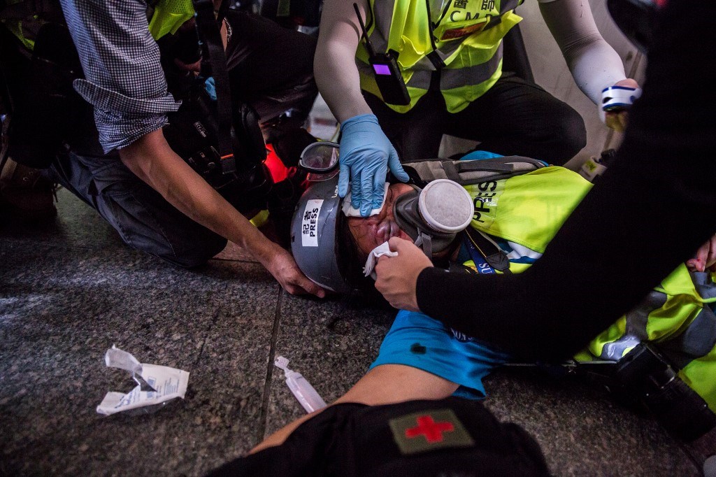 印尼女記者英達(中)9月29日疑似遭港警持槍射中右眼眼眉,醫生診治後指出,英達的右眼將永久失明。(法新社提供)
