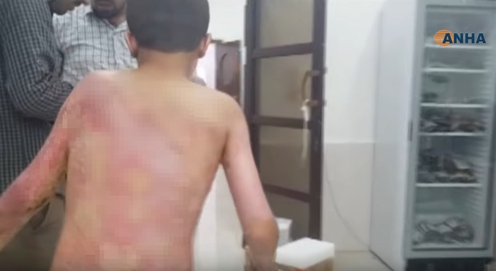 土耳其軍隊對敘利亞北部地區的庫德族發動攻擊,出現愈來愈多使用化武白磷的報告。圖為男孩疑遭化武灼傷畫面。(圖取自hewar news YouTube頻道youtube.com)