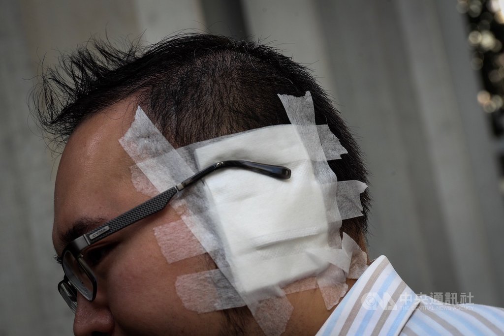 近來香港反送中爆發激烈警民衝突,香港民主派議員趙家賢(圖)3日在太古城調停持刀傷人事件時遭男子咬耳,造成左耳耳廓永久壞死,21日才出院。他22日上街拜票時表示,現在仍會頭暈且還無法穩穩走路,需倚靠輔助。中央社記者吳家昇攝 108年11月22日