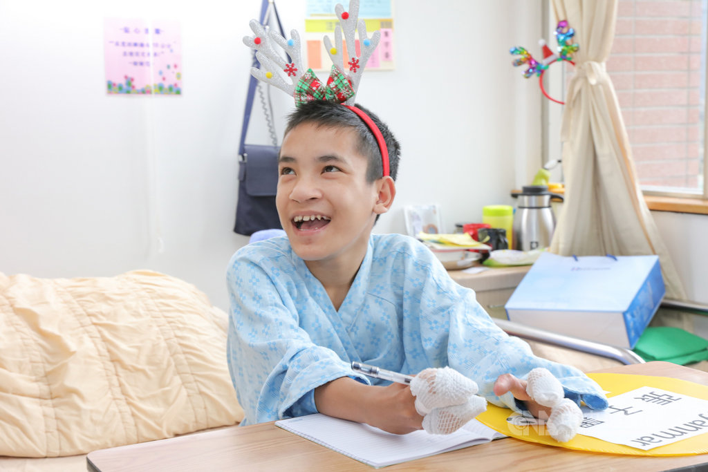 今年15歲的緬甸男孩張子墨患有先天性手掌五指骨並連的疾病,手就像鴨掌一樣,不論做什麼事情,都必須兩手合作,生活相當不便。新光醫院資助他來台手術,圓單手寫字夢想。(新光醫院提供)中央社記者陳偉婷傳真 108年12月23日