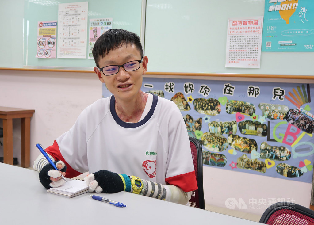罹患先天性表皮鬆解性水皰症、俗稱「泡泡龍」的學子唐煒勛從小樂觀正向,專注於課業,17日也將參加大學學測,立志就讀外文系。中央社記者王淑芬攝 109年1月16日