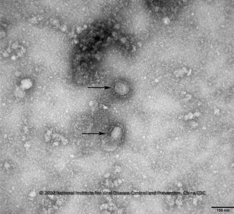 世界衛生組織專家顧問費格丁說,2019新型冠狀病毒(2019-nCoV)流行病爆發的嚴重程度可能是「熱核反應級別」。圖為電子顯微鏡下的新型冠狀病毒。(韓國疾病管理本部/韓聯社提供)