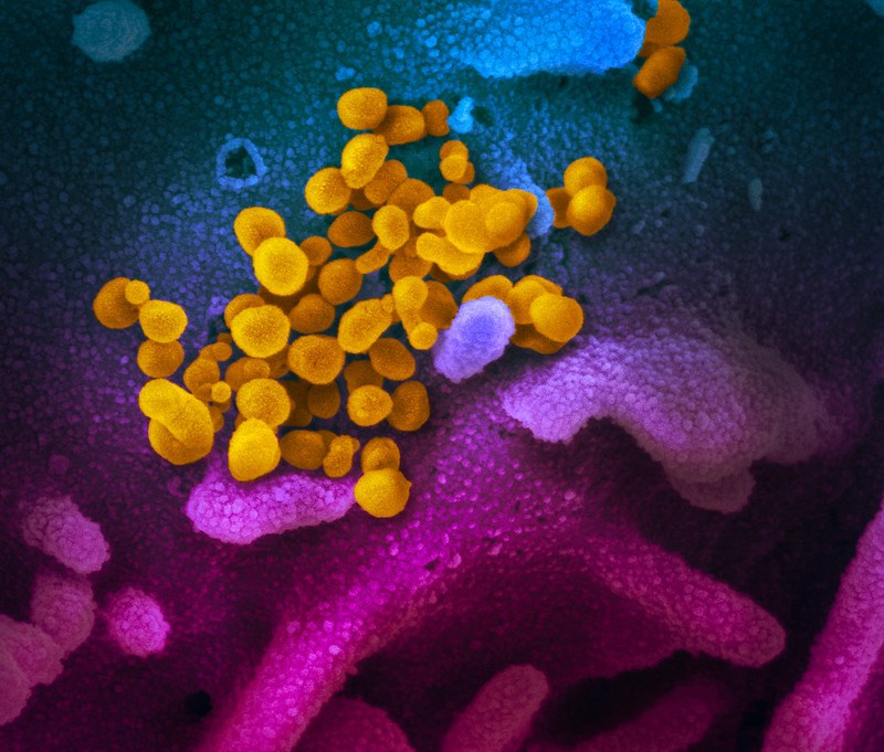 美國國家過敏與傳染病研究院13日公布在掃描式電子顯微鏡上觀察到的新型冠狀病毒影像，病毒上黃色，細胞表面上藍色和粉紅色。（圖取自NIAID flickr網頁；作者：NIAID-RML，CC BY 2.0）