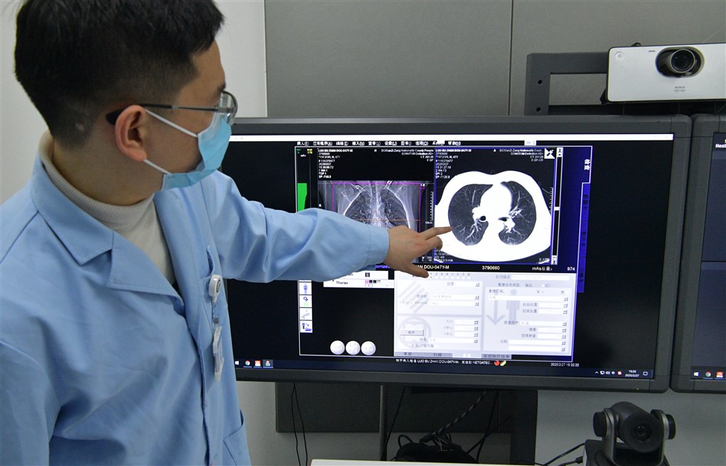 香港一項醫學研究模擬武漢肺炎病毒在人體肺部的發展情況，發現病毒繁殖率高於SARS 3倍以上。圖為四川成都醫生利用武漢肺炎患者肺部顯影討論病情。（檔案照片／中新社提供）