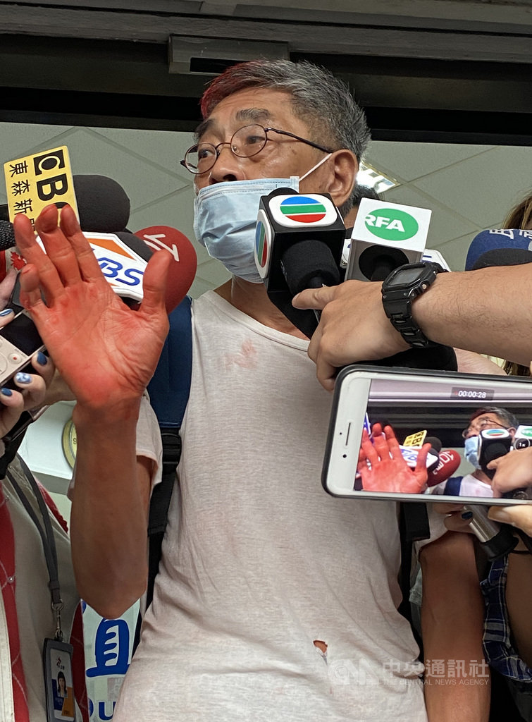 前香港銅鑼灣書店店長林榮基(中)21日上午在台北突遭人潑紅漆,林榮基下午作完筆錄後受訪表示,目前全案交警方處理,並說「台灣警察是這樣(手勢比讚),香港警察是這樣(手勢比倒讚)」,同時也感謝各界關心。中央社記者黃麗芸攝 109年4月21日