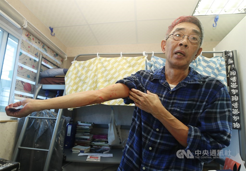 香港銅鑼灣書店前店長林榮基21日上午近9時單獨在北市中山區中山北路一段巷弄內的咖啡店用餐,突遭一名著深色衣褲的不明男子潑漆,造成林榮基頭部、衣褲都是紅漆污漬。圖為林榮基22日在書店受訪時,展示手肘上的油漆。中央社記者張新偉攝 109年4月22日