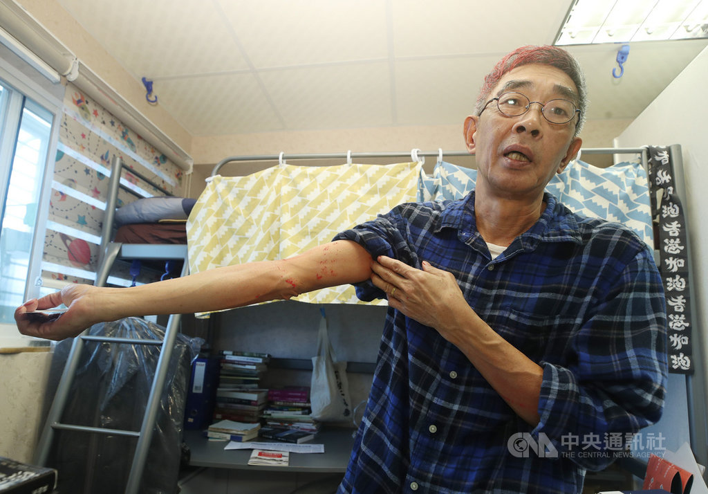 香港銅鑼灣書店前店長林榮基21日上午近9時單獨在北市中山區中山北路一段巷弄內的咖啡店用餐,突遭一名著深色衣褲的不明男子潑漆,造成林榮基頭部、衣褲都是紅漆污漬。圖為林榮基22日在書店受訪時,展示手肘上的油漆。中央社記者張新偉攝 109年4月22日