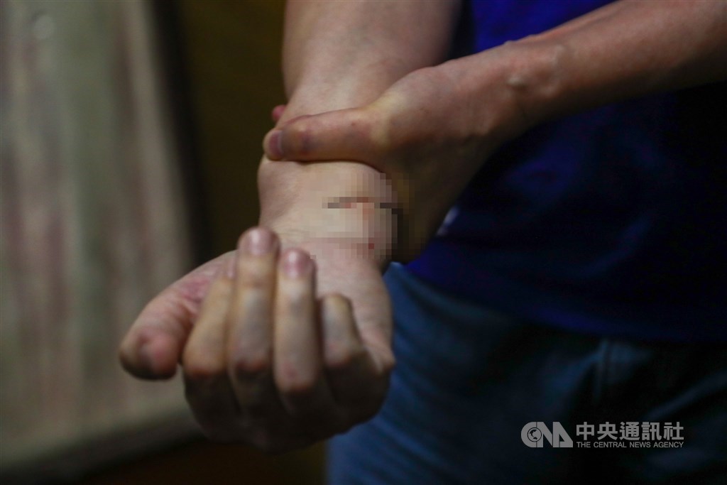 立法院臨時會14日審查監察院人事案,朝野立委爆發激烈肢體衝突,國民黨立委費鴻泰(圖)右手遭到玻璃劃傷。中央社記者王騰毅攝 109年7月14日