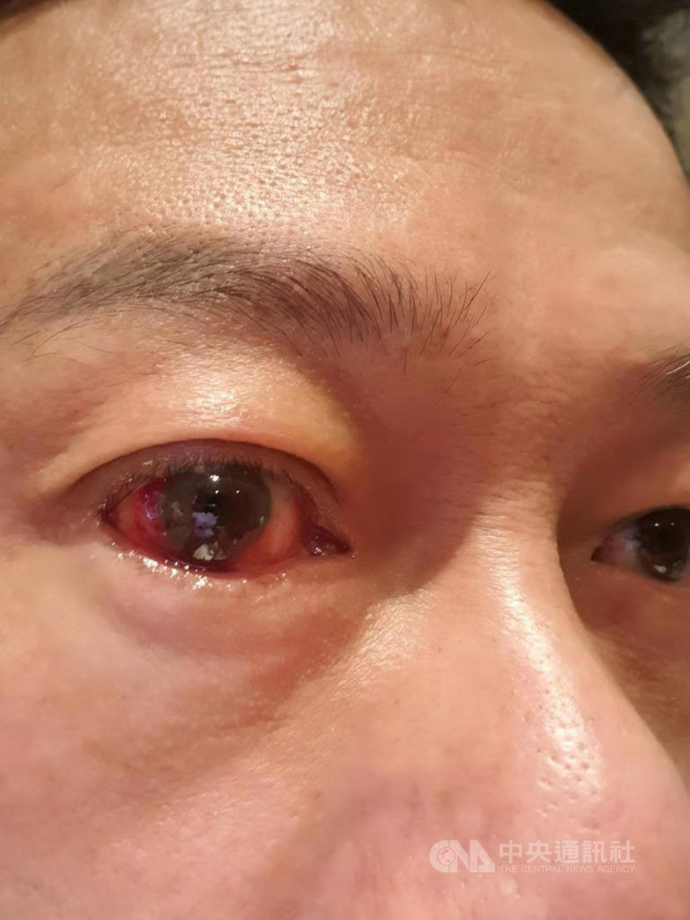 國片「馗降:粽邪2」由金馬影帝李康生主演,電影上映前夕,李康生卻發現眼睛充血,與電影中角色中邪時症狀相同,成為意外巧合。(李康生提供)中央社記者王心妤傳真 109年9月8日