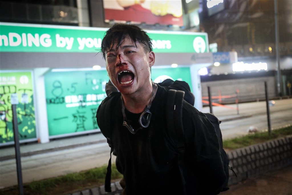 中央社記者吳家昇曾3度前往香港採訪拍攝。獲得PX3肯定的「香港示威者被便衣警察襲擊」、「香港示威者的無聲吶喊」作品,是吳家昇第一次被派到香港時所拍攝,且照片中的人皆是同一人。(中央社檔案照片)