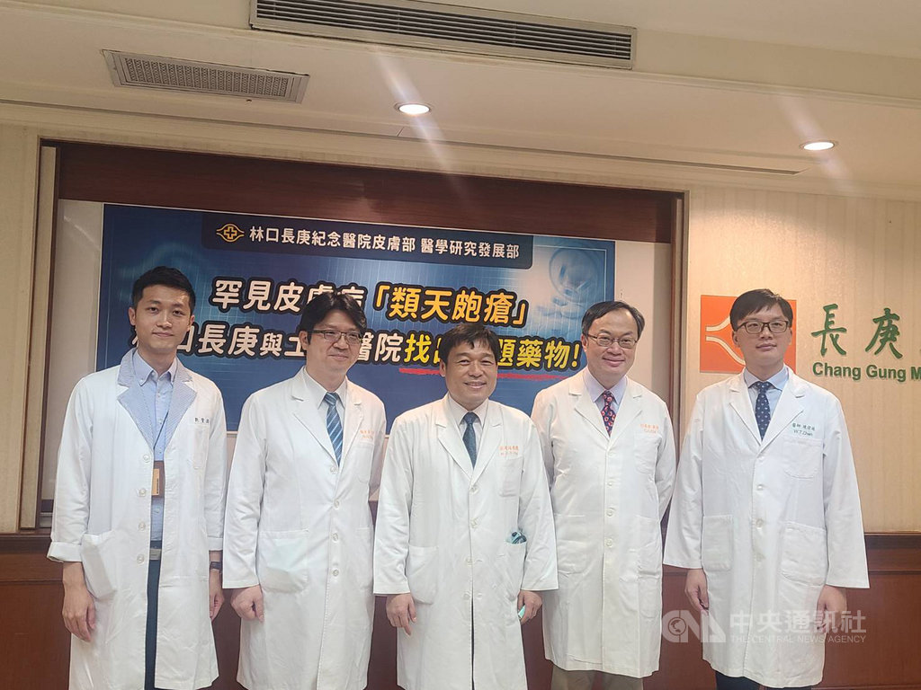 長庚醫院16日上午召開記者會公布最新研究成果,研究發現,特定降血糖藥、保鉀型利尿劑及帕金森氏症藥品,恐增加罕見皮膚病「類天皰瘡」風險,若蕁麻疹好不了或出現飽滿水泡應立即就醫。中央社記者張茗喧攝 109年9月16日