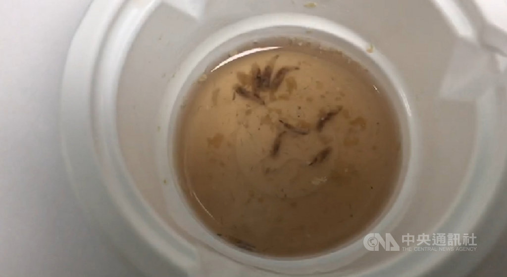 86歲老翁最近感覺耳朵非常不舒服,似乎有東西在蠕動,在家人陪同下前往榮民醫院台東分院看診,醫師看了相當驚訝,指出有可能是蒼蠅竄進老翁耳朵裡產卵後孵化成蛆,還好能及時發現送醫治療,將蛆蟲自耳朵夾出。(民眾提供)中央社記者盧太城台東傳真 109年9月22日