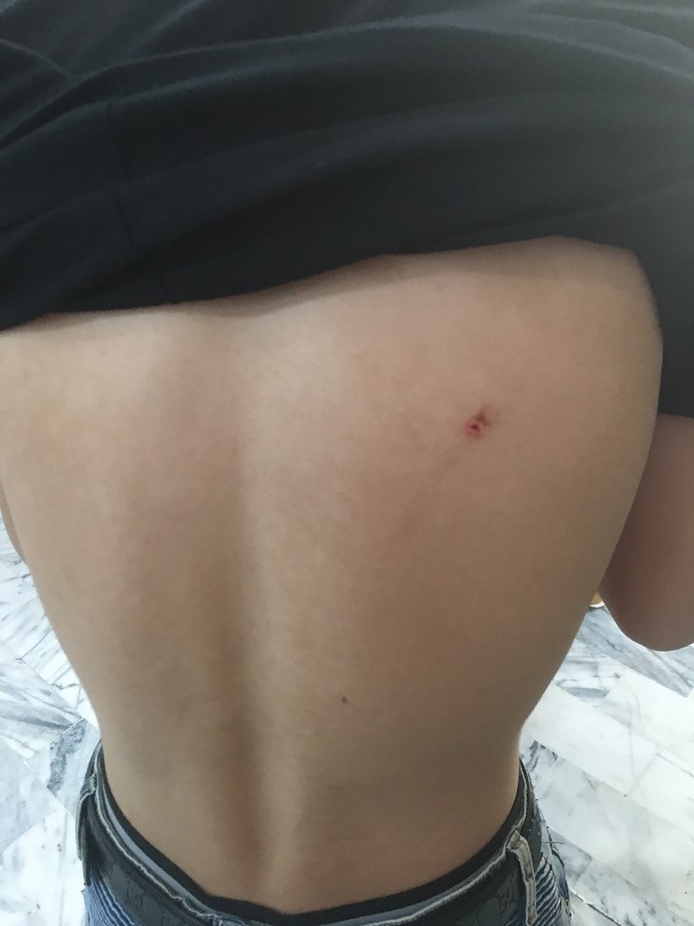 高雄市黃姓男子25日在高雄地檢署外被素未謀面的蕭姓男子上前搭話,蕭男還持折疊刀劃傷黃男背部,所幸僅皮肉傷,不需就醫。(高雄市警局新興分局提供)中央社記者洪學廣傳真 109年9月25日