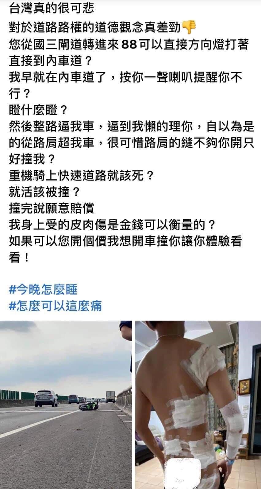 遭水產行貨車的鄭姓重機騎士在臉書貼出自己全身貼滿紗布的照片表示,小貨車駕駛一路逼車,質疑難道「重機騎上快速道路就該死?就活該被撞?」(圖取自爆料公社網頁bc3ts.net)