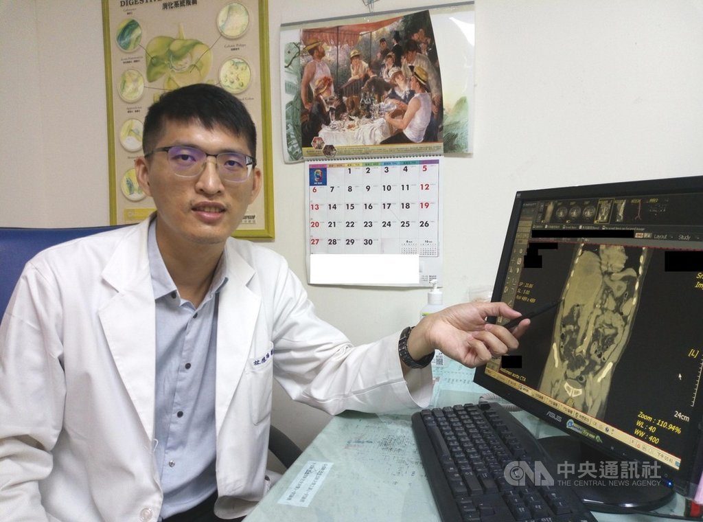 苗栗大千綜合醫院肝膽腸胃科醫師林德福(圖)29日表示,肝動脈化療對肝腫瘤採用低劑量化療,對肝臟傷害少且安全性高,有3成以上患者獲得部分及完全治療成效。(大千綜合醫院提供)中央社記者管瑞平傳真 109年9月29日