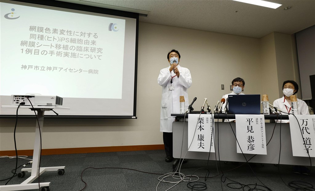 日本位於神戶市的研究團隊16日宣布,本月上旬成功用誘導性多功能幹細胞(iPS)製作的視細胞,移植至視網膜色素變性症患者的視網膜上,這是全球首例。(共同社)