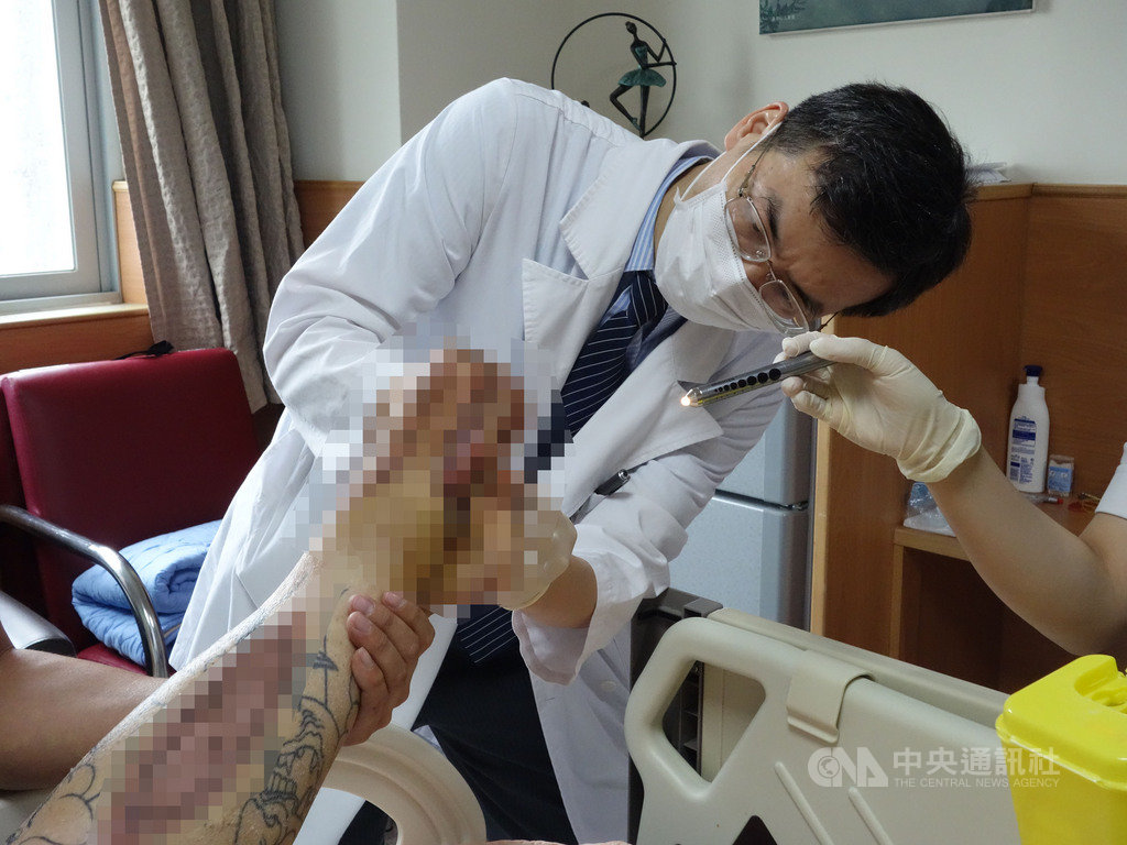 蔡姓男子因血糖過高併發急性左下肢血栓與腔室症候群,導致左腳掌發黑壞死,恐需截肢保命,大林慈濟醫院整形外科主任黃介琦(圖)以顯微游離皮瓣重建手術讓患者免於截肢。(大林慈濟醫院提供)中央社記者蔡智明傳真 109年11月17日