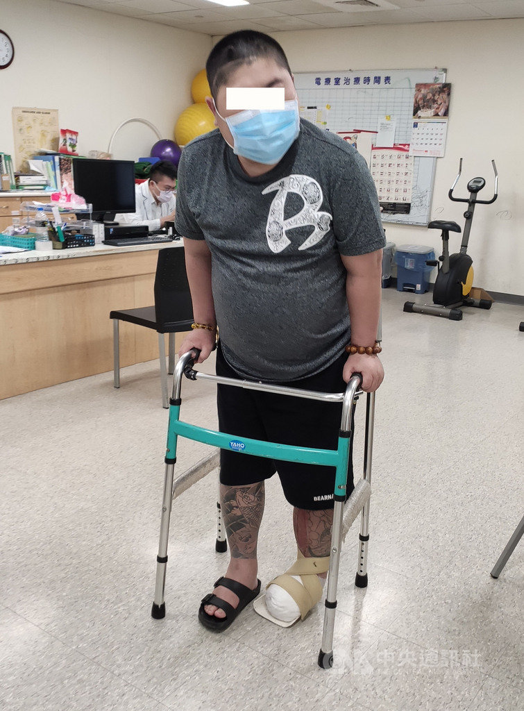 蔡姓男子因血糖過高併發急性左下肢血栓與腔室症候群,導致左腳掌發黑壞死,大林慈濟醫院以顯微游離皮瓣重建手術,重建腳掌免於截肢命運,患者住院75天後出院,目前已能用助行器走路。(大林慈濟醫院提供)中央社記者蔡智明傳真 109年11月17日