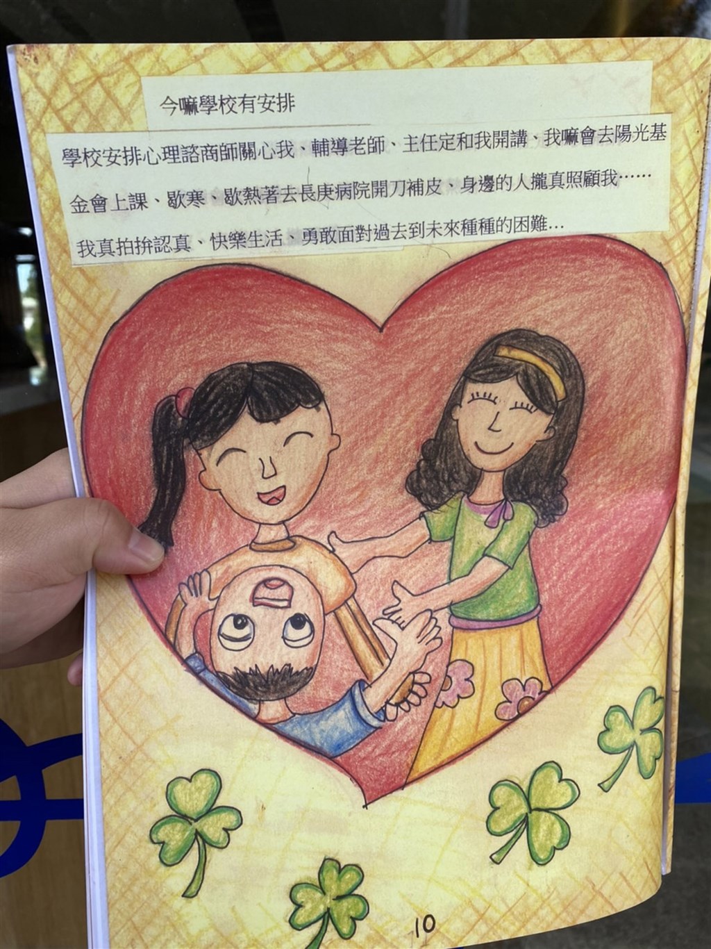就讀國一的小辰在國小時因火災意外,全身52%面積燒傷,母親與弟弟更在意外中不幸離世,小辰忍痛復健並將傷後故事製成繪本,希望能鼓勵他人。(陽光基金會提供)中央社記者郝雪卿傳真 109年12月6日