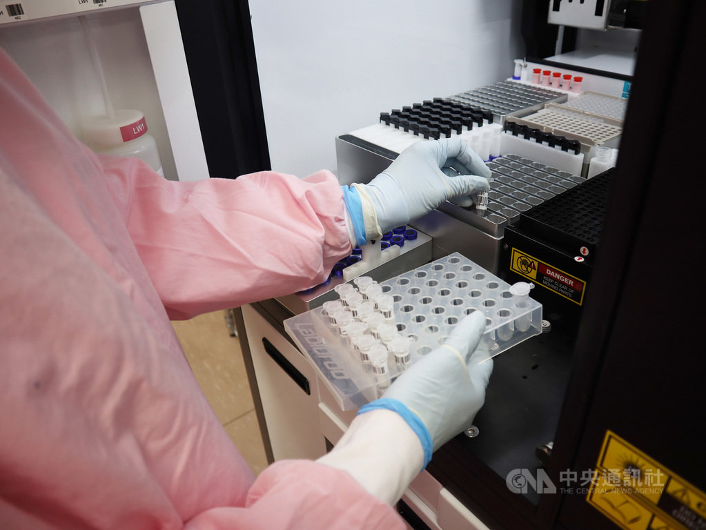 衛生福利部台北醫院13日表示,提供一站式篩檢武漢肺炎(2019新冠狀病毒疾病,COVID-19)流程,希望幫民眾快速完成篩檢。醫檢師放置經特定核酸萃取步驟處理的檢體,監測病毒反應。(台北醫院提供)中央社記者黃旭昇新北傳真 110年1月13日
