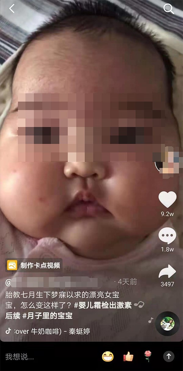 澎湃新聞報導,多名家長反映,自家嬰兒在使用「戒之館」品牌嬰親霜後出現臉部腫大、多毛、發育遲緩等「大臉娃娃」症狀。(圖取自澎湃新聞網頁thepaper.cn)