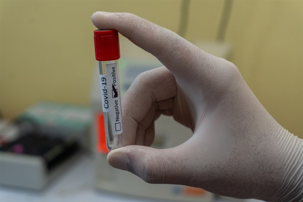 根據愛丁堡大學研究,英國又發現2019冠狀病毒疾病新變種病毒株B1525,迄今在英國發現23例,另外也在丹麥、美國和澳洲等10國的病毒基因定序中被檢出。(示意圖/圖取自Unsplash圖庫)